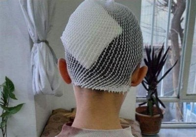 کلاس درس یا میدان خشم؟/ پرتاب لیوان سر دانشآموز گلستانی را شکافت