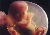 سونوگرافی در 10 هفته اول بارداری ممنوع