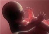 نوزاد 3 ماه پس از مرگ مغزی مادرش متولد شد