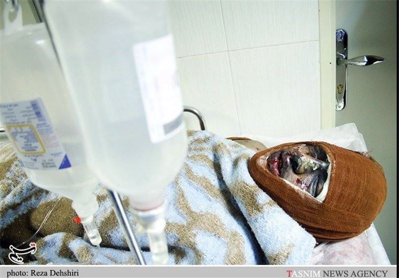 فوت 58 نفر بر اثر سوختگی در کرمانشاه