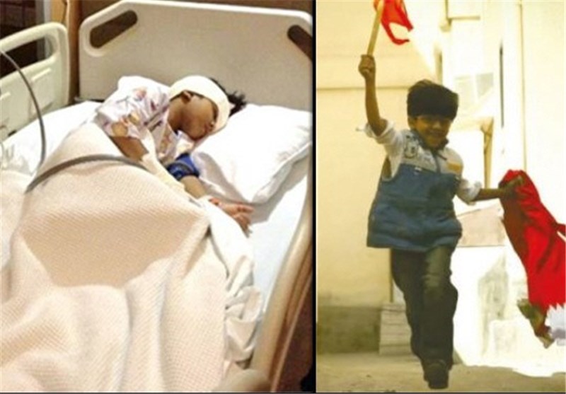 کودک بحرینی بر اثر اصابت گلوله نظامیان آل‌خلیفه نابینا شد