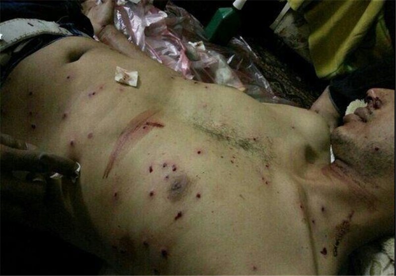 إصابة بلیغة لشاب بحرینی برصاص الشوزن المحرم دولیا فی قریة &quot;دمستان&quot;