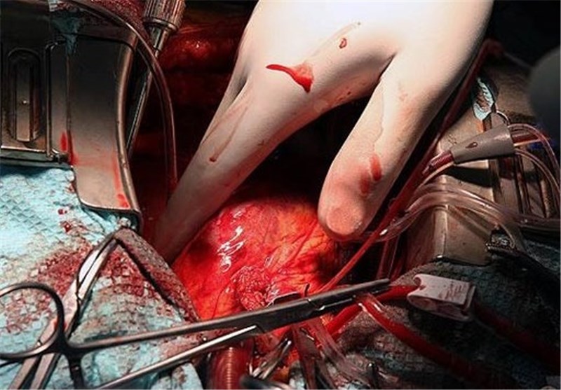 3000 عمل جراحی قلب باز در بیمارستان شریعتی مشهد انجام شد