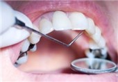 14 میلیارد ریال در جنوب کرمان برای تجهیزات دندانپزشکی هزینه شد