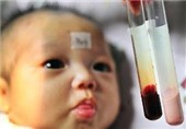شناسایی بیش از 1780 نوزاد مبتلا به هیپوتیروئید در خوزستان