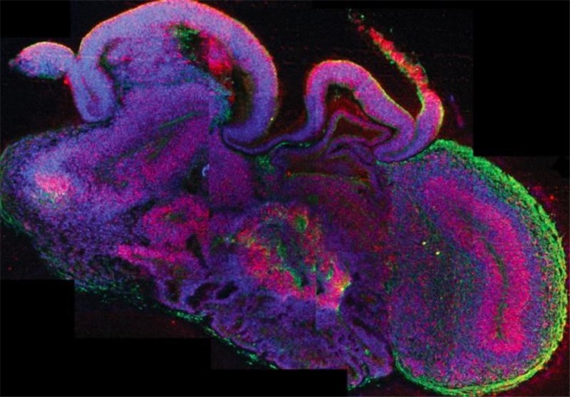 Scientists Grow Human Brain Tissue in 3-D Culture System