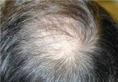 روغن کنجد خواص بیشماری در پیشگیری و درمان ریزش مو دارد