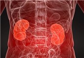 Researchers Identify Protein Needed for Repair of Injured Kidney Cells