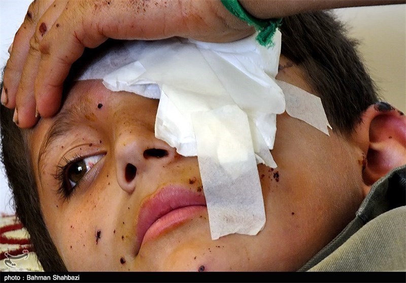 وضعیت جسمانی دانش آموزان حادثه انفجار «مین» مساعد است/تمام هزینه‌های درمان رایگان