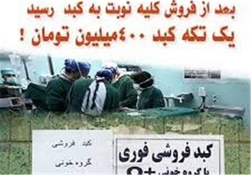 ماجرای فروش کبد 4 میلیاردی/کمترین زمان جراحی پیوند کبد دنیا متعلق به ایران