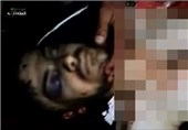 سرقت اعضای بدن مجروحان سوری در بیمارستان‌های ترکیه