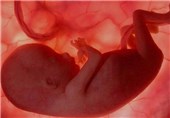 راه‌هایی برای رشد هوش جنین