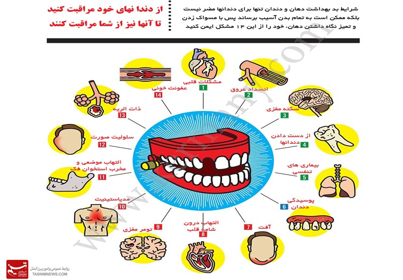 بهداشت نامناسب دندانی باعث 14 عارضه و بیماری می‌شود