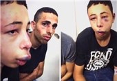 واکنش آمریکا به ضرب و جرح نوجوان فلسطینی توسط اسرائیل