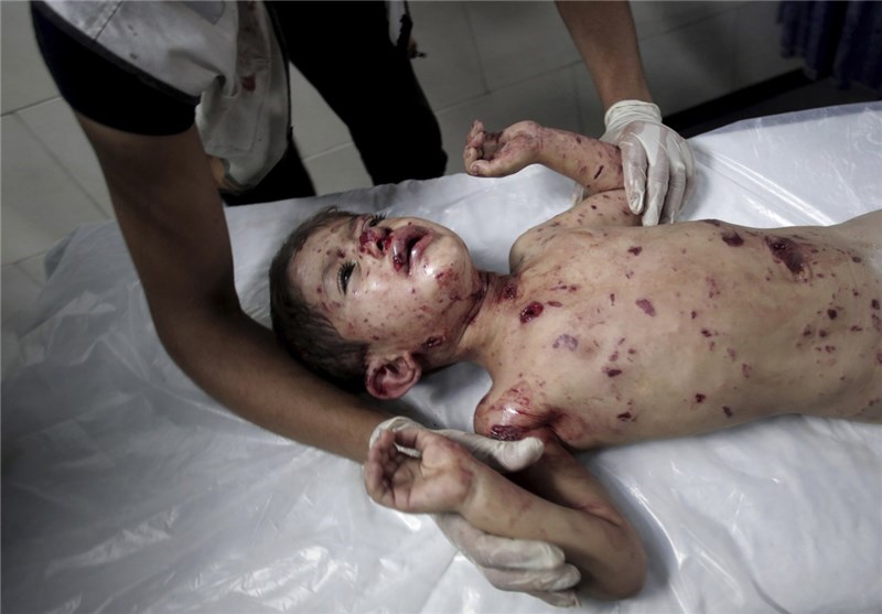 Zionist Massacres in Gaza Continue: Death Toll over 630