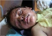 وزارت بهداشت غزه: روز چهارشنبه 73 فلسطینی در غزه شهید شدند
