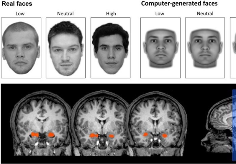 کشف منشأ اجتماعی بهره هوشی مغز