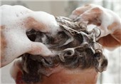 چه بیماری‌هایی باعث ریزش مو می‌شوند؟