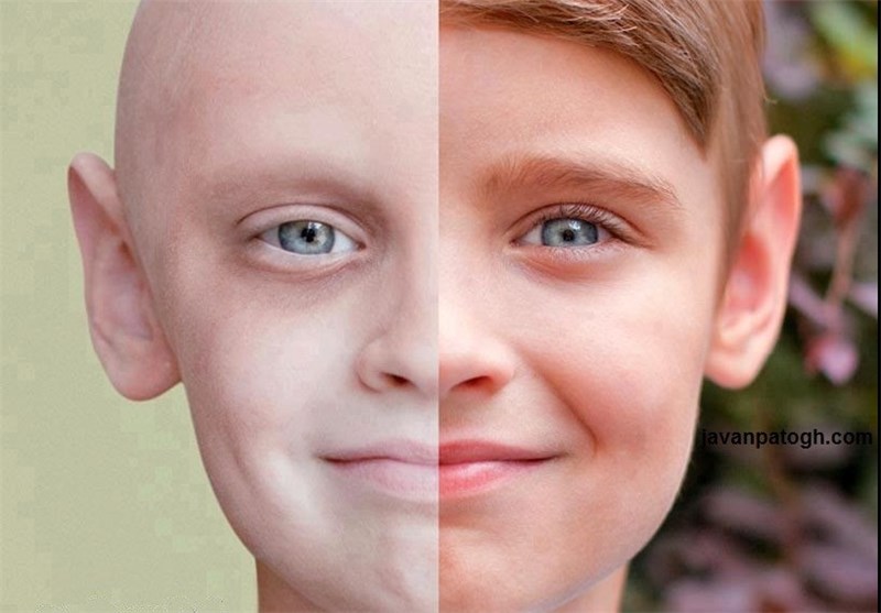 شیوه باور نکردنی پسر خردسال برای مقابله با سرطان + تصاویر