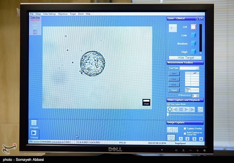 Researchers Discover New Possible Explanation for Female Infertility