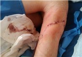 جزئیات تازه از حمله به طلبه آمر به معروف در لرستان/ خودداری بیمارستان از پذیرش طلبه مجروح شده