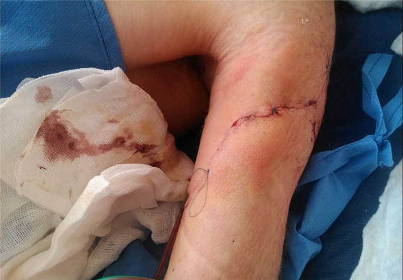 جزئیات تازه از حمله به طلبه آمر به معروف در لرستان/ خودداری بیمارستان از پذیرش طلبه مجروح شده