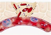 افت ‌پلاکت ‌خون خطرناک است؟