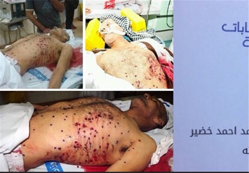 پرونده سیاه آل خلیفه و حقوق بشر؛ابعاد تکان دهنده خشونت حاکمان بحرین