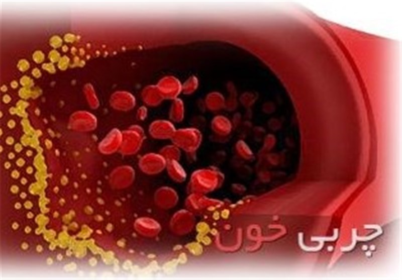 چربی خون یکی از مهم‌ترین علل بروز تصلب شرایین در جهان است