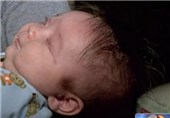 تولد نوزاد بدون چشم در آمریکا