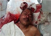 ترور یکی از رهبران انصارالله در استان إب یمن