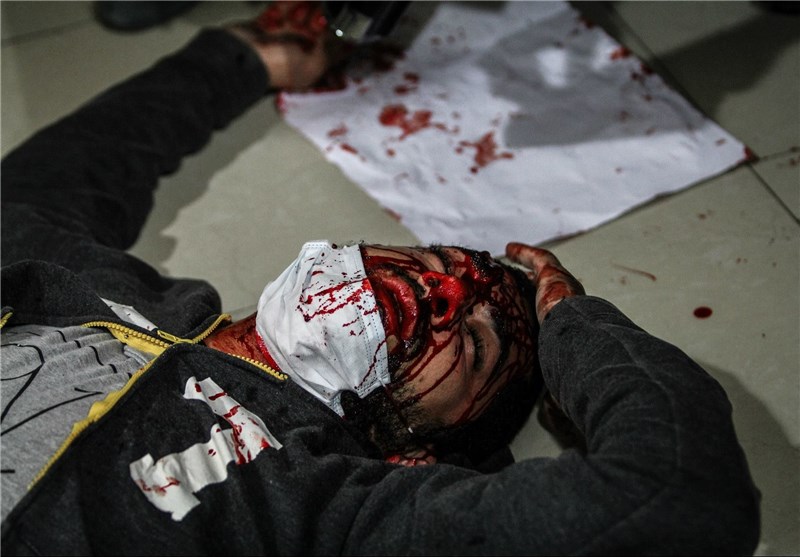 وخامت جسمی یک قربانی شکنجه در بحرین