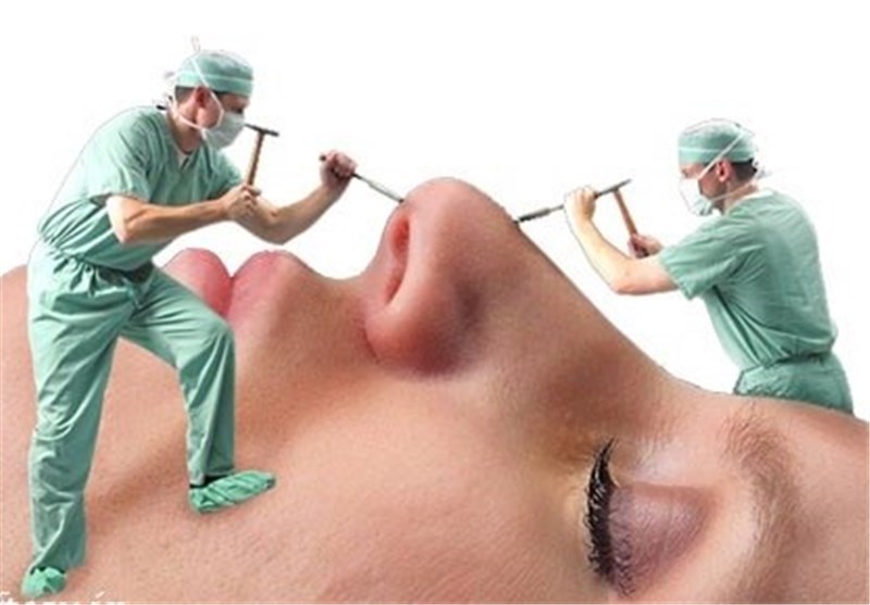 رئیس‌کل نظام پزشکی: ایرانی‌ها بیشترین متقاضی‌ جراحی زیبایی در دنیا؛ موافق دستگاه کارتخوان در مطب‌ها هستیم