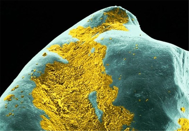 تصاویر میکروسکوپی از آلودگی های دندان