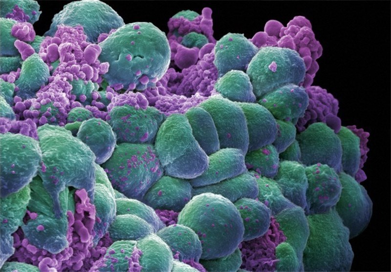 ابزار ژنتیک‌محور شناسایی سلول‌های سرطانی