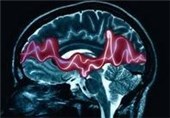 Type 1 Diabetes Linked to Epilepsy Risk, Study Suggests