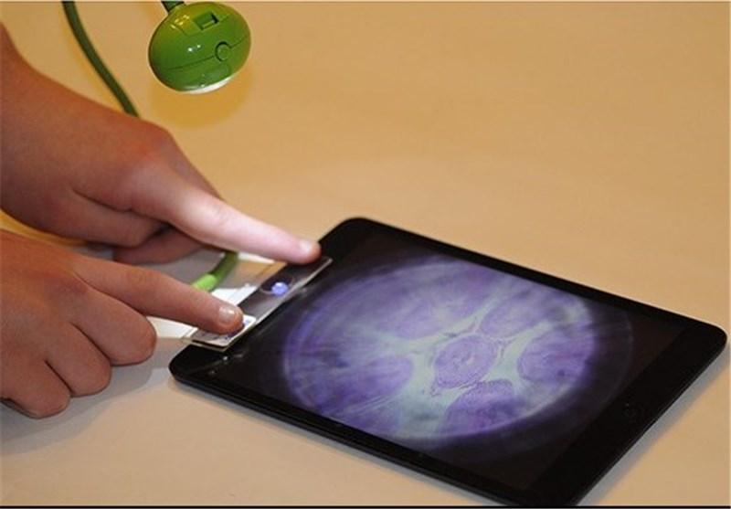 Lens Turns any Smartphone into Portable Microscope
