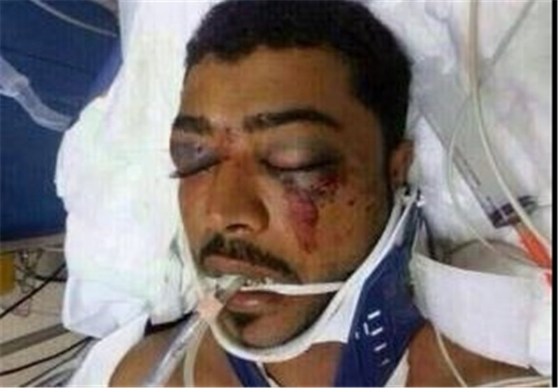 شهادت جوان بحرینی پس از 55 روز بستری در بیمارستان