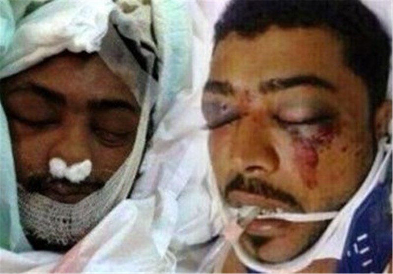 الشهید الـ 123 لثورة الکرامة بالبحرین : المواطن عبدالعزیز العبار یلتحق برکب الشهداء بعد إصابته بطلقات ناریة