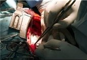 انجام 50 عمل پیوند قلب توسط پزشکان اصفهانی