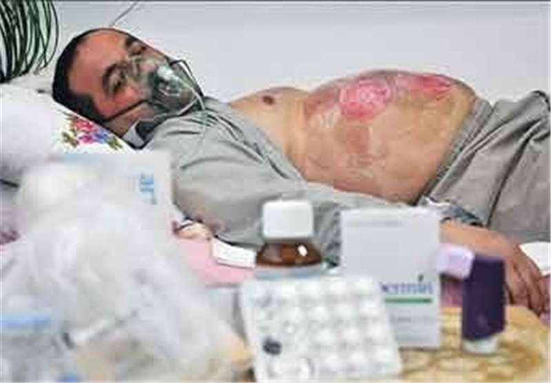 مازندران| توجه مسئولان باید به جانبازان شیمیایی بیشتر شود