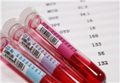 HDL در آزمایش خون به چه معناست؟