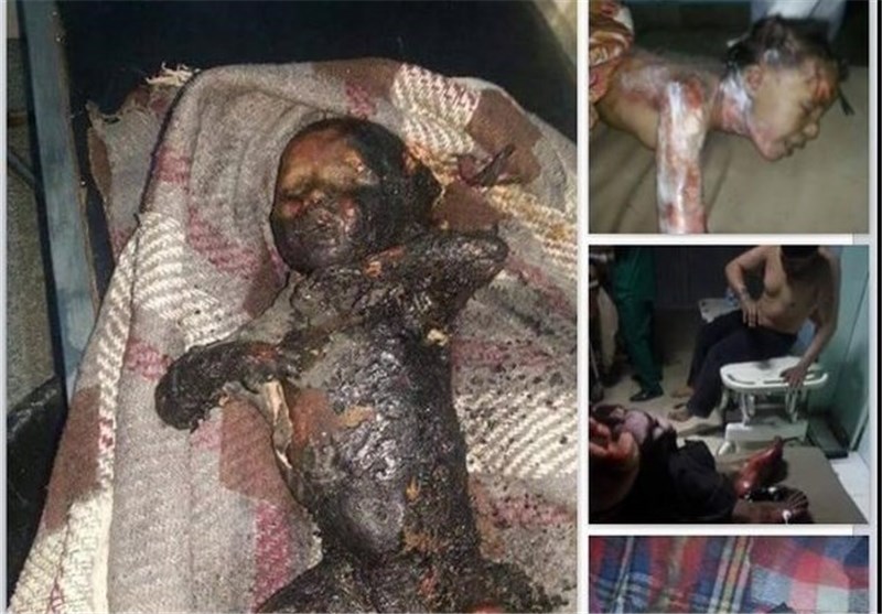 Yemen Savaşı Çocukları Vuruyor