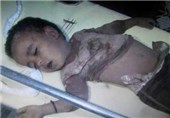 سازمان ملل: جهان خود را برای بدترین سناریو در یمن آماده کند