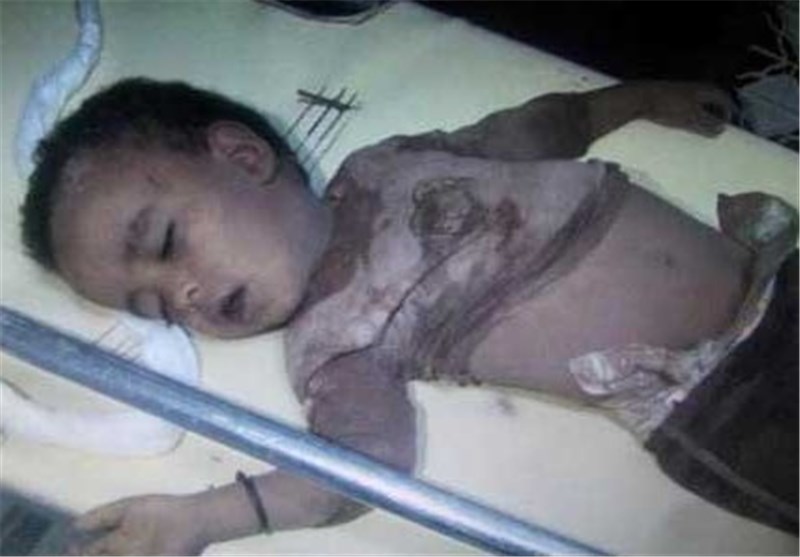 180 Children Killed in Saudi-Led War on Yemen