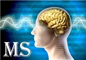 New MRI Technique Offers Faster Diagnosis of Multiple Sclerosis