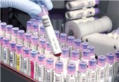 180 هزار نمونه سلول‌های بنیادی خون بند ناف در ایران ذخیره‌سازی شد