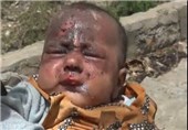 حقوق کودکان یمن زیر چکمه آل سعود