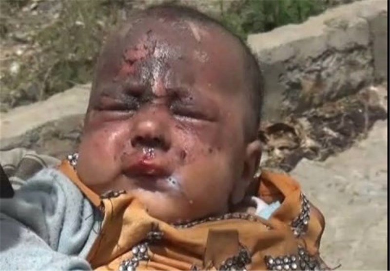 یمن: آل سعود کی جانب سے مسلط کردہ تین سالہ جنگ کے دوران 85 ہزار بچے شہید ہوئے، رپورٹ