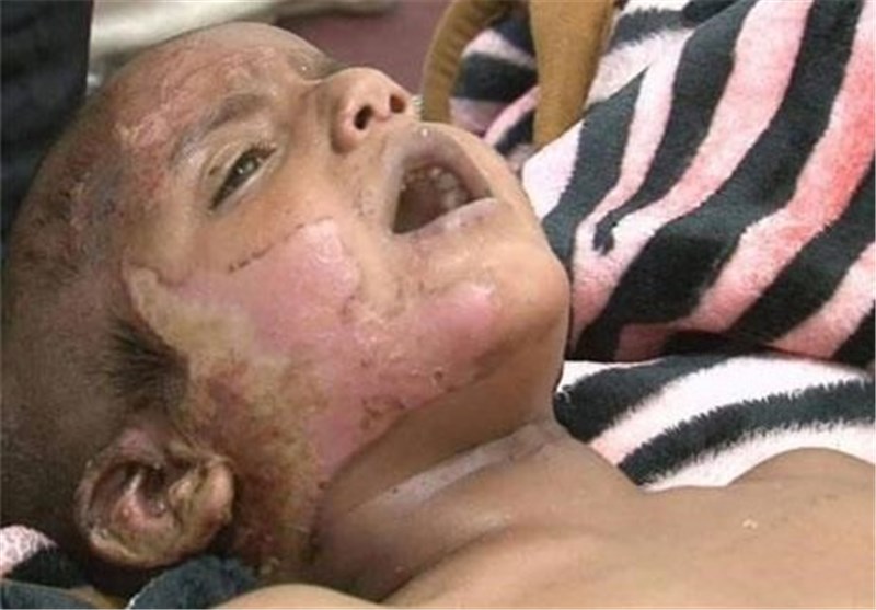 بیش از 20 شهید در بمباران یک مدرسه و مرکز بهداشت در یمن
